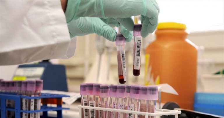 Αναμένεται η επανάκτηση της διαπίστευσης του Εργαστηρίου αντι-ντόπινγκ της Αθήνας από τον WADA