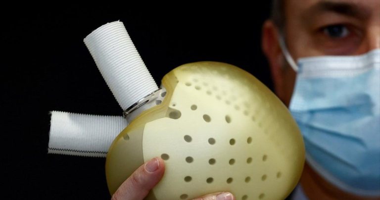 Η εταιρεία Carmat ανέστειλε προσωρινά τις εμφυτεύσεις τεχνητής καρδιάς λόγω «προβλήματος ποιότητας»